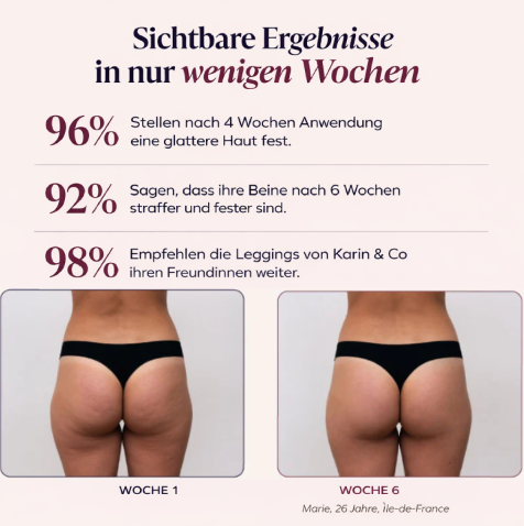 3D-Leggings | Altrosa