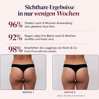 3D-Leggings | Altrosa